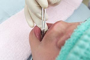 前橋でいびき治療を行うならここへ