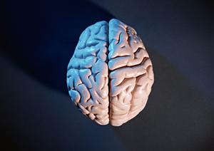 名古屋で目立たないインビザライン