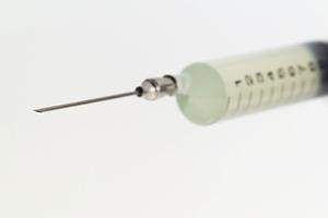 マウスピース矯正の治療をするメリット