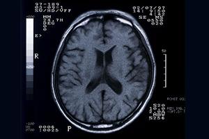 三ノ輪の歯医者徹底比較！2026年最新版で見つける信頼できる歯科クリニック